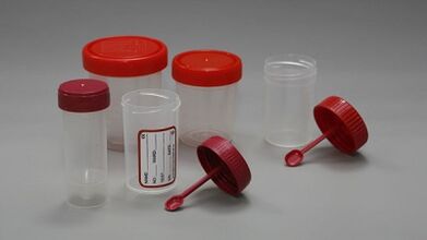 Comment se préparer au test parasite